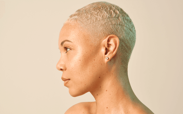 The Future of Skin Regeneration: Why Natural-Looking Results Are Revolutionizing Aesthetic Medicine